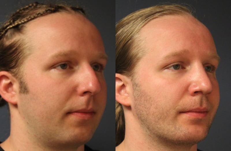 before_after_img