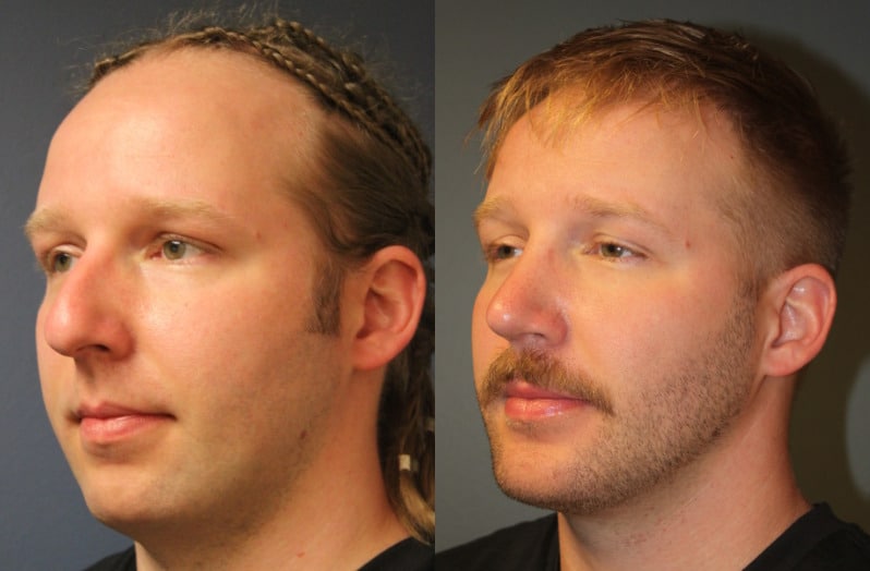before_after_img