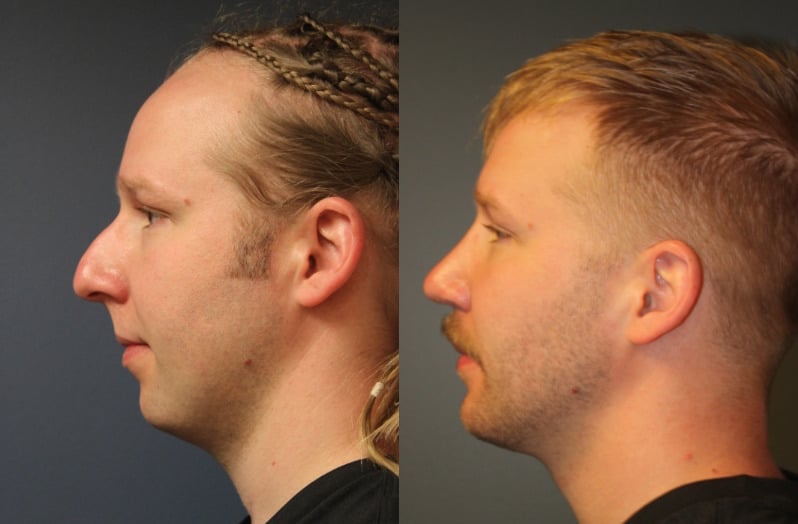 before_after_img