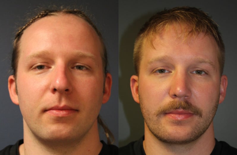 before_after_img