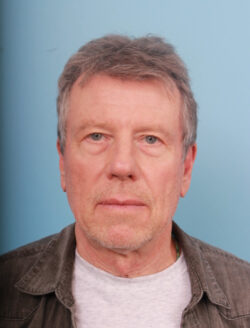 before blepharoplasty