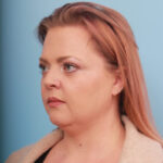liposuction-before-3