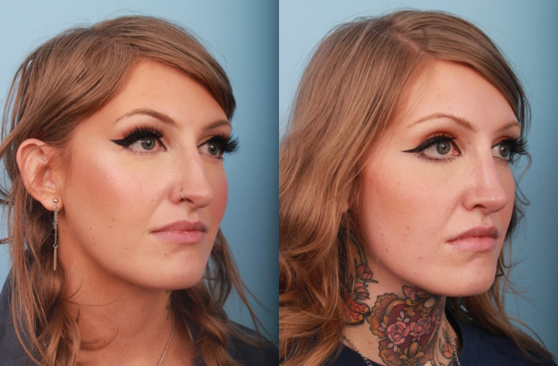 before_after_img
