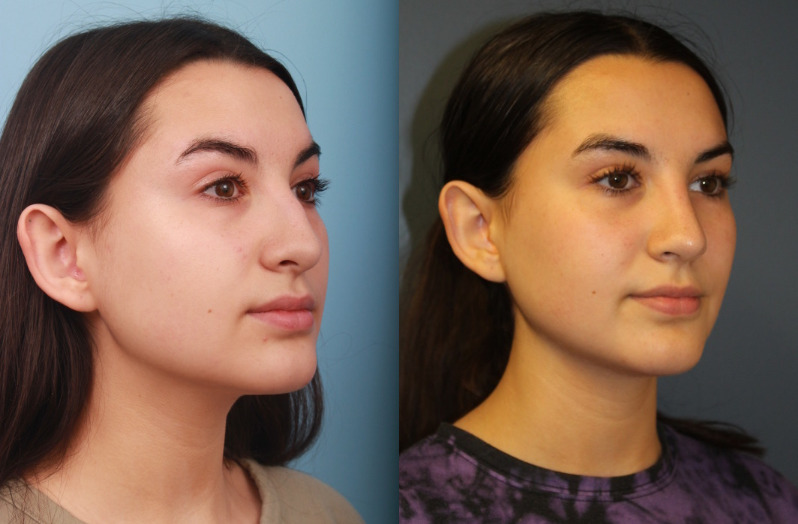 before_after_img