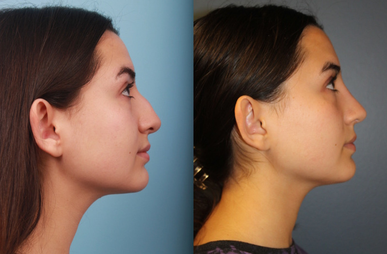 before_after_img