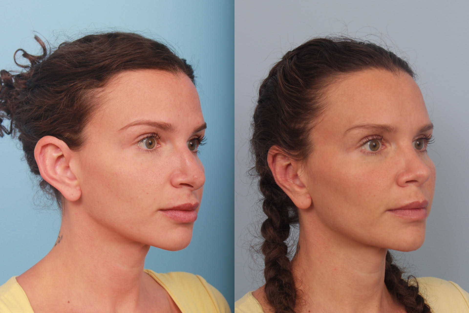 before_after_img