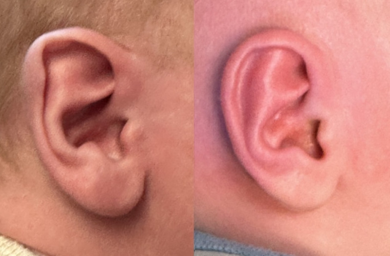 before_after_img