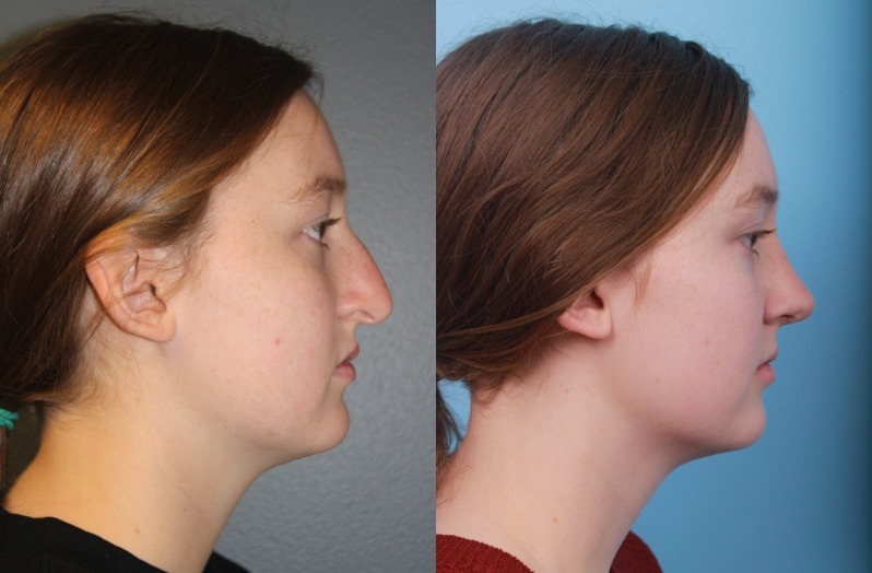 before_after_img