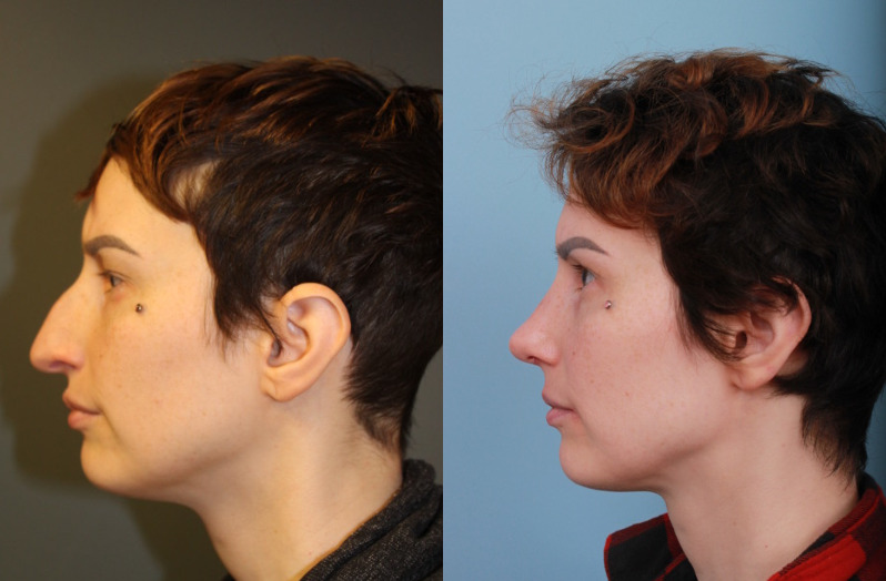 before_after_img