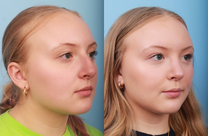 before_after_img