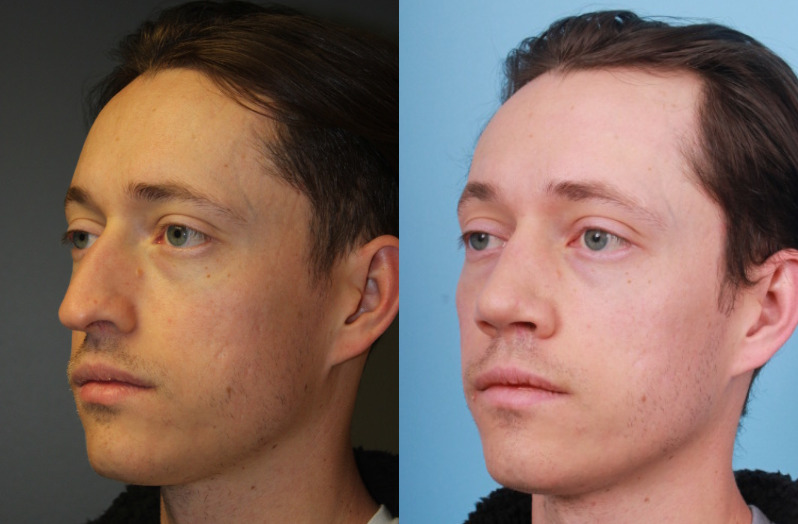 before_after_img