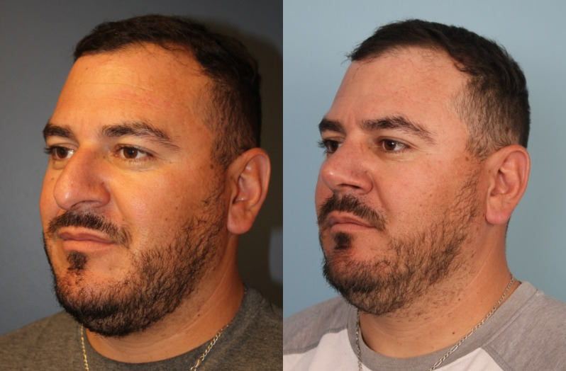 before_after_img