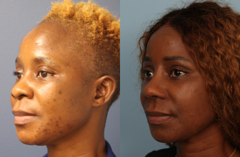 before_after_img
