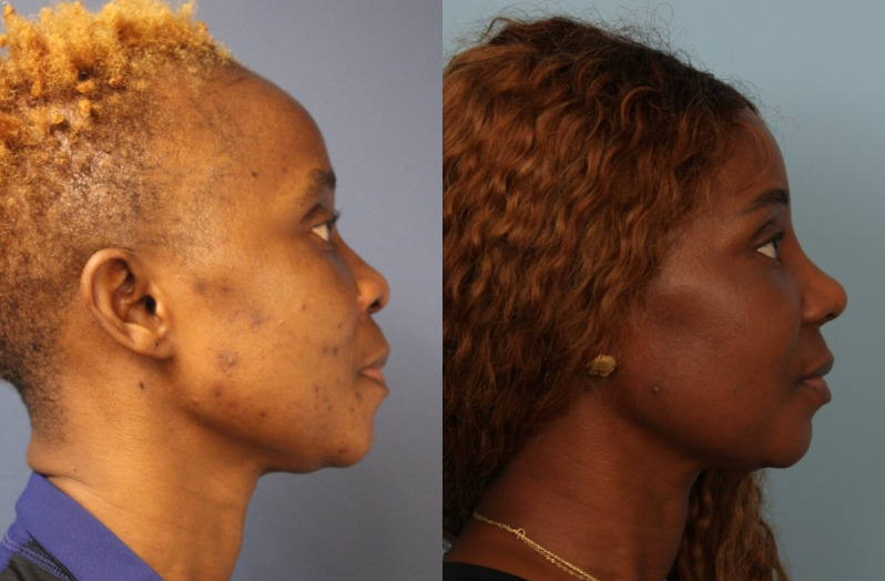 before_after_img