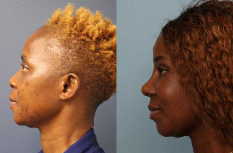 before_after_img