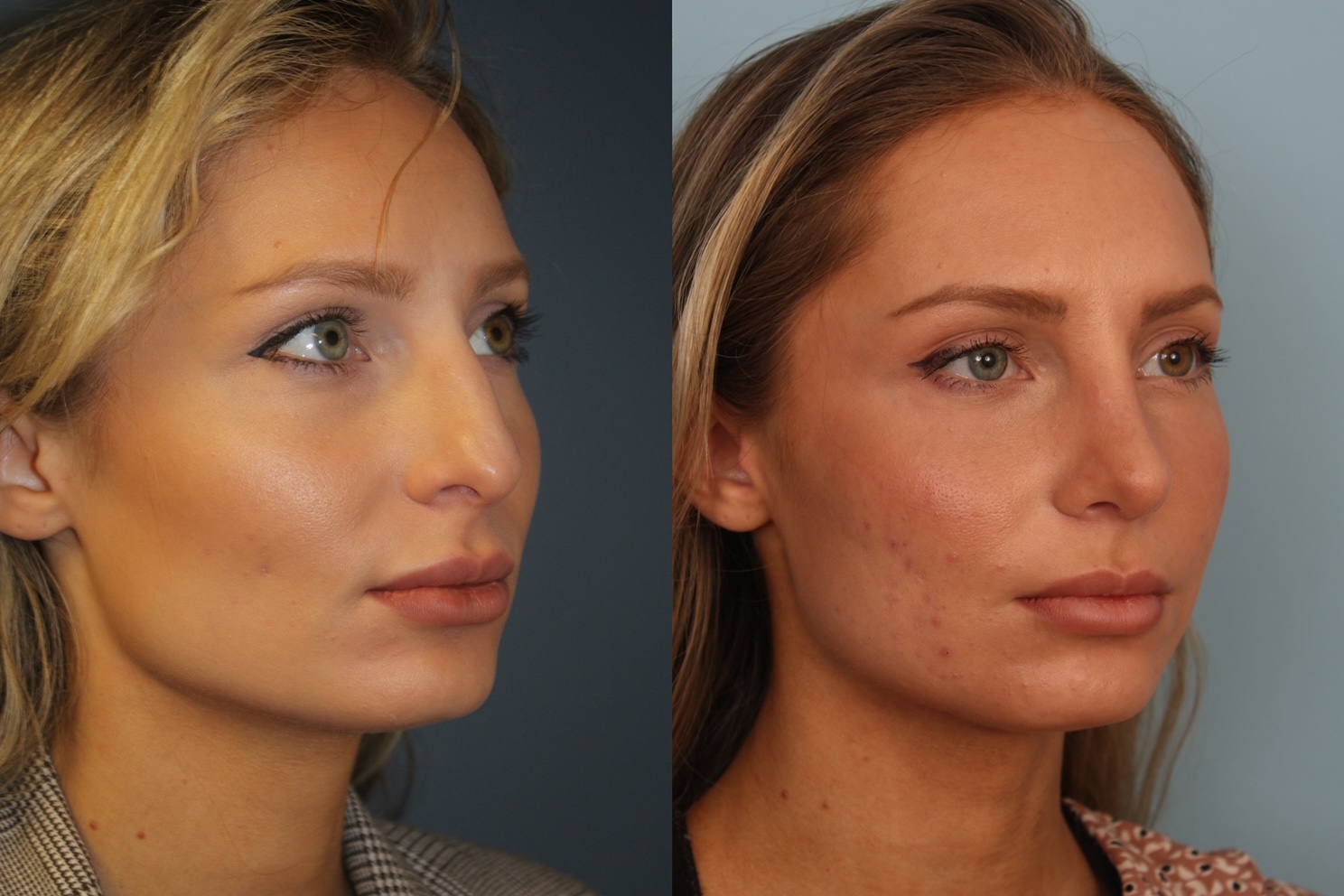 before_after_img