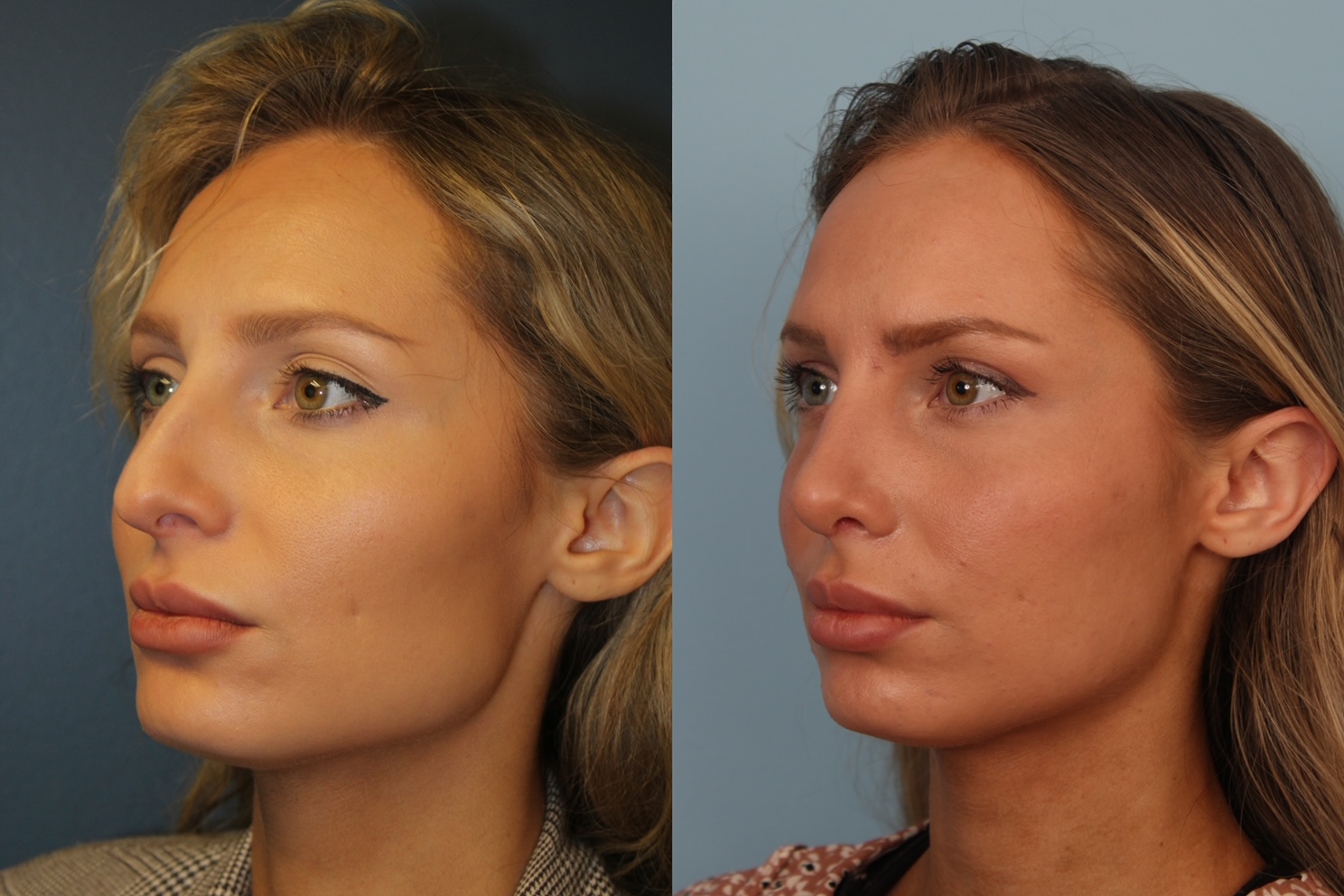 before_after_img
