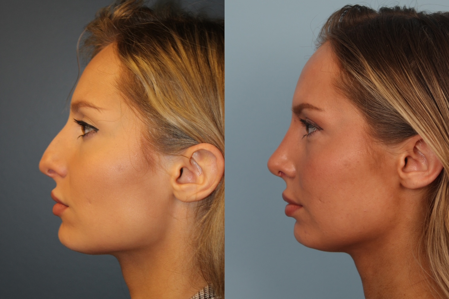 before_after_img
