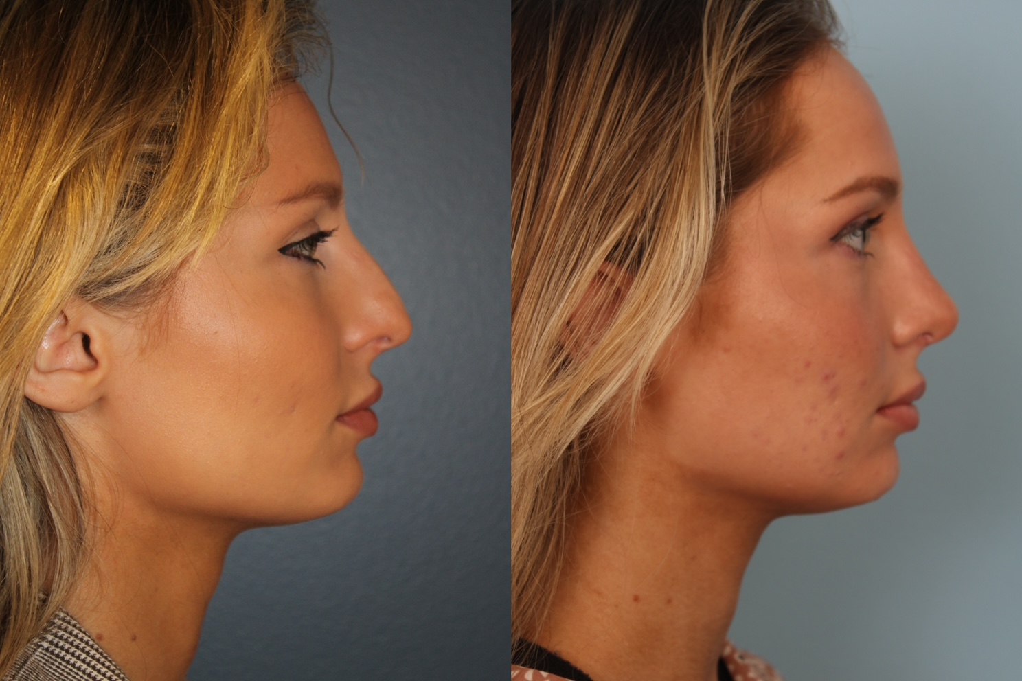 before_after_img