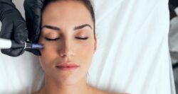 Microneedling woman