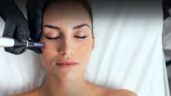 Microneedling woman