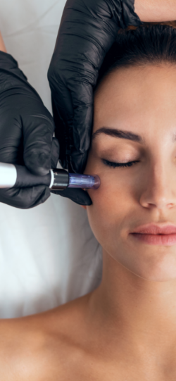 Microneedling woman