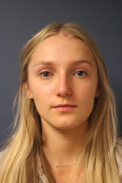 before rhinoplasty
