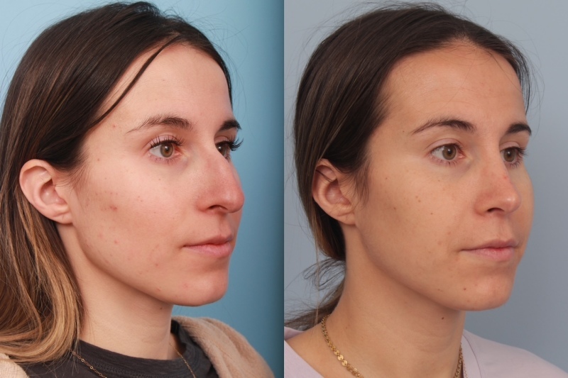 before_after_img