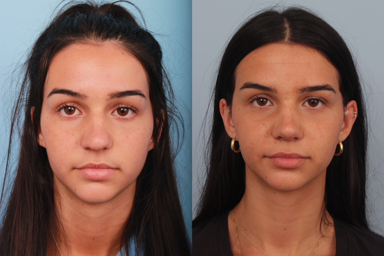 before_after_img