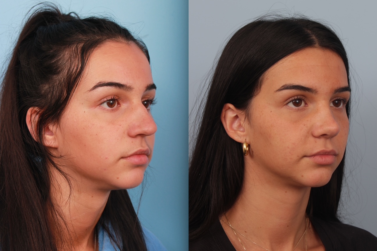 before_after_img
