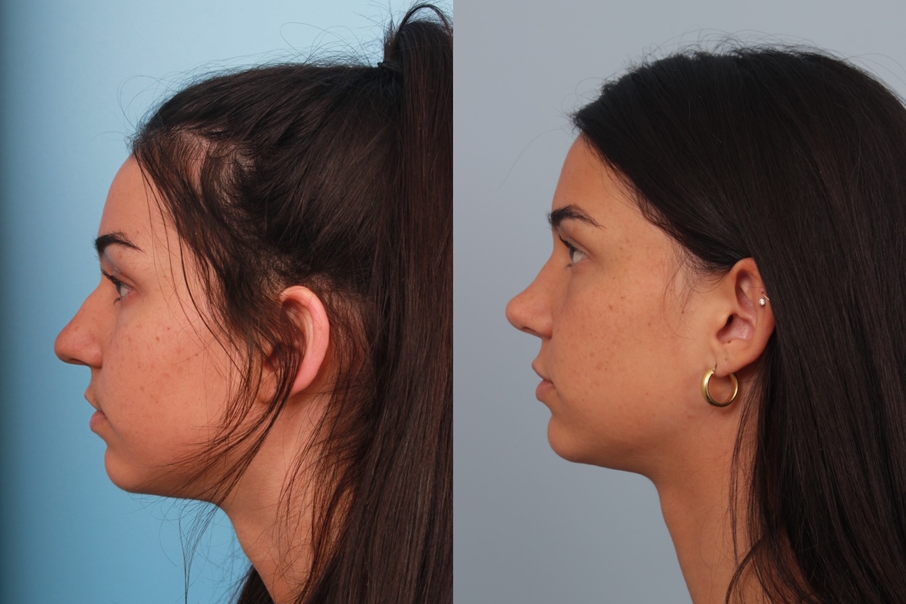 before_after_img