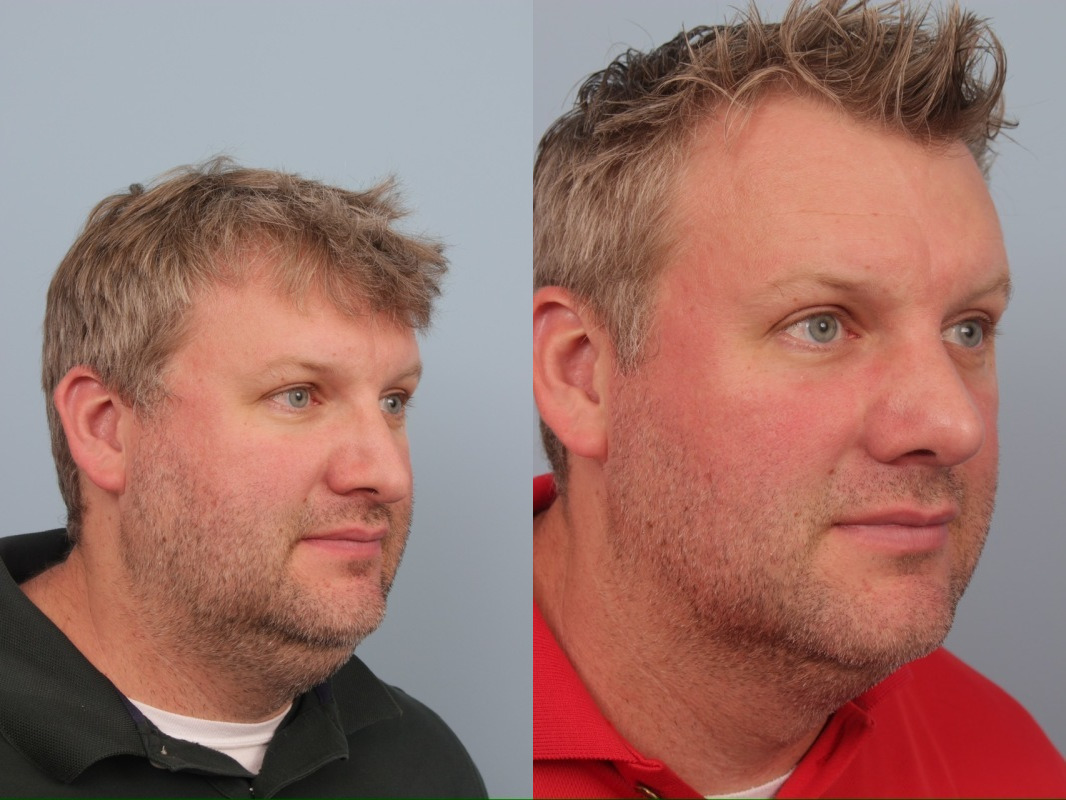 before_after_img
