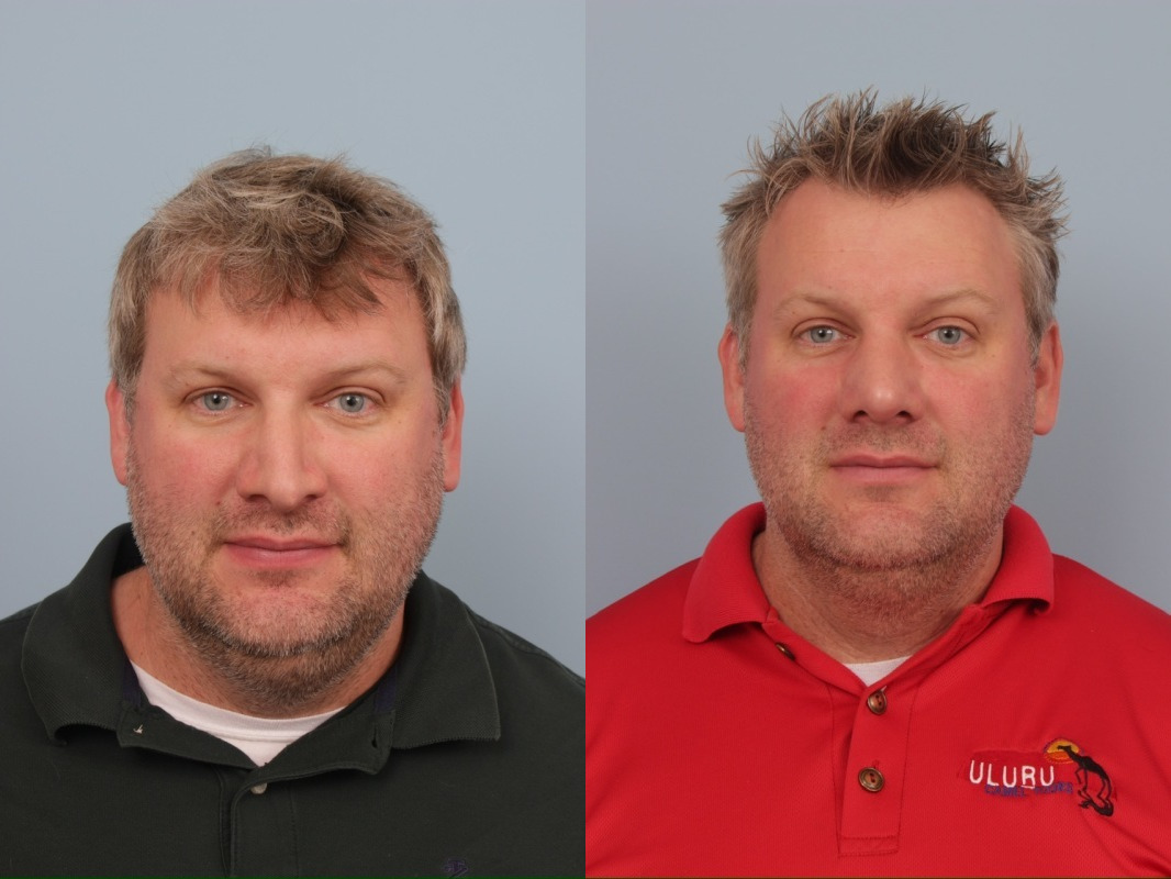 before_after_img