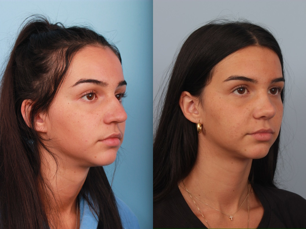 before_after_img