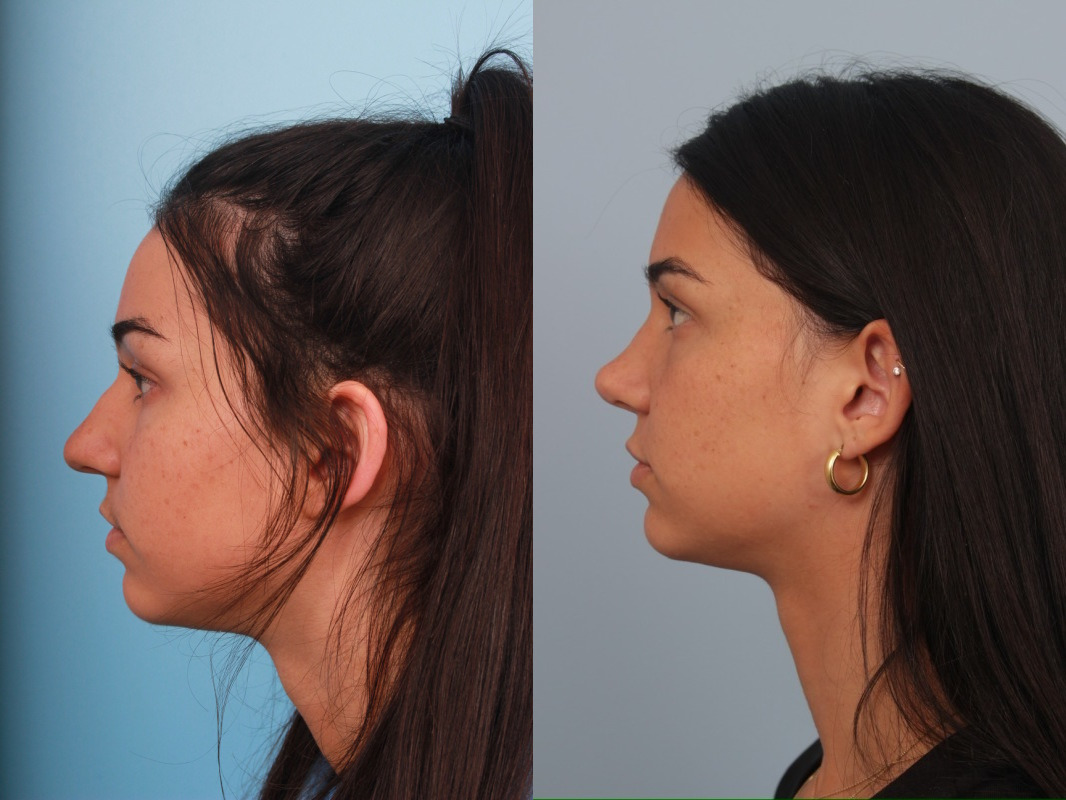 before_after_img