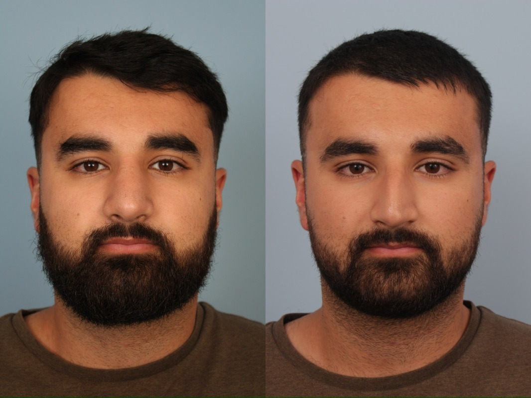 before_after_img