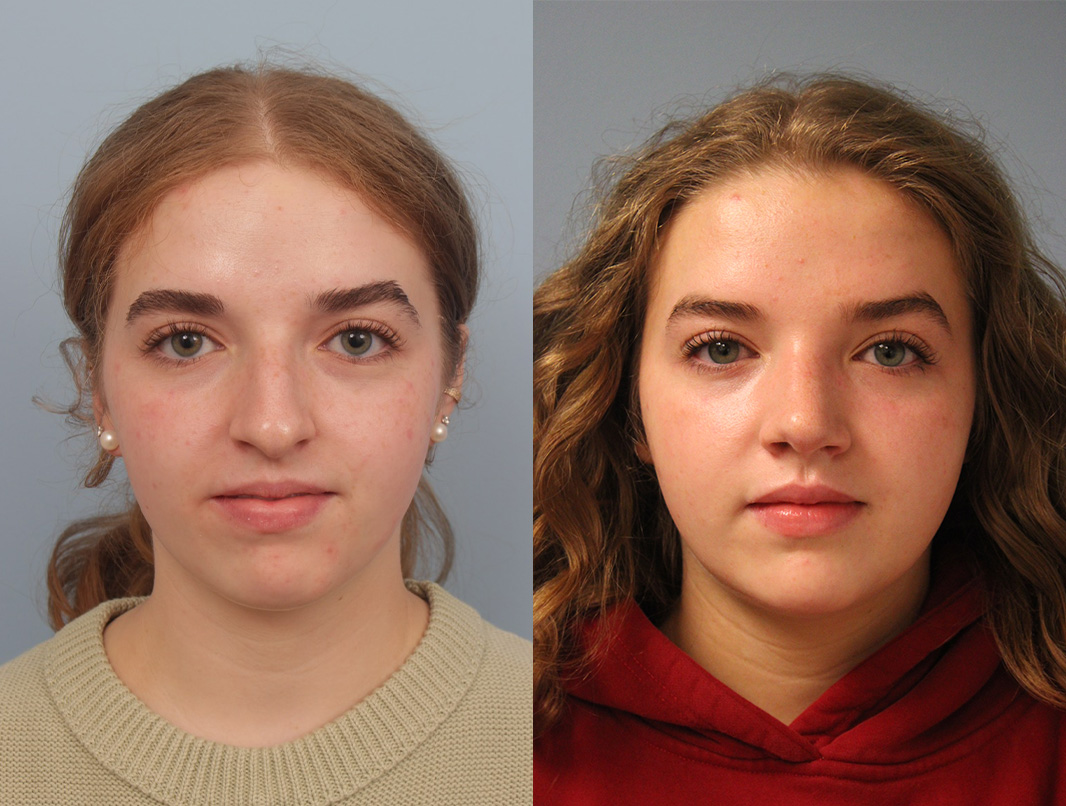 combined-image