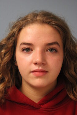 after rhinoplasty