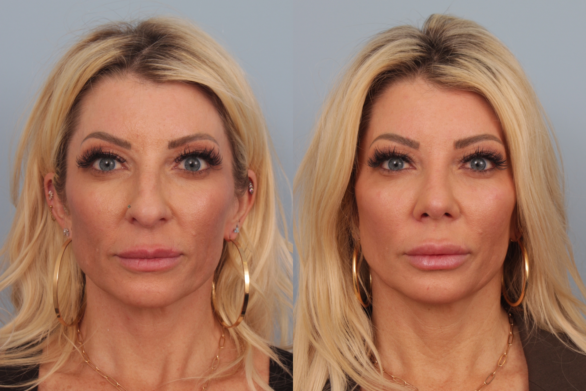 before_after_img