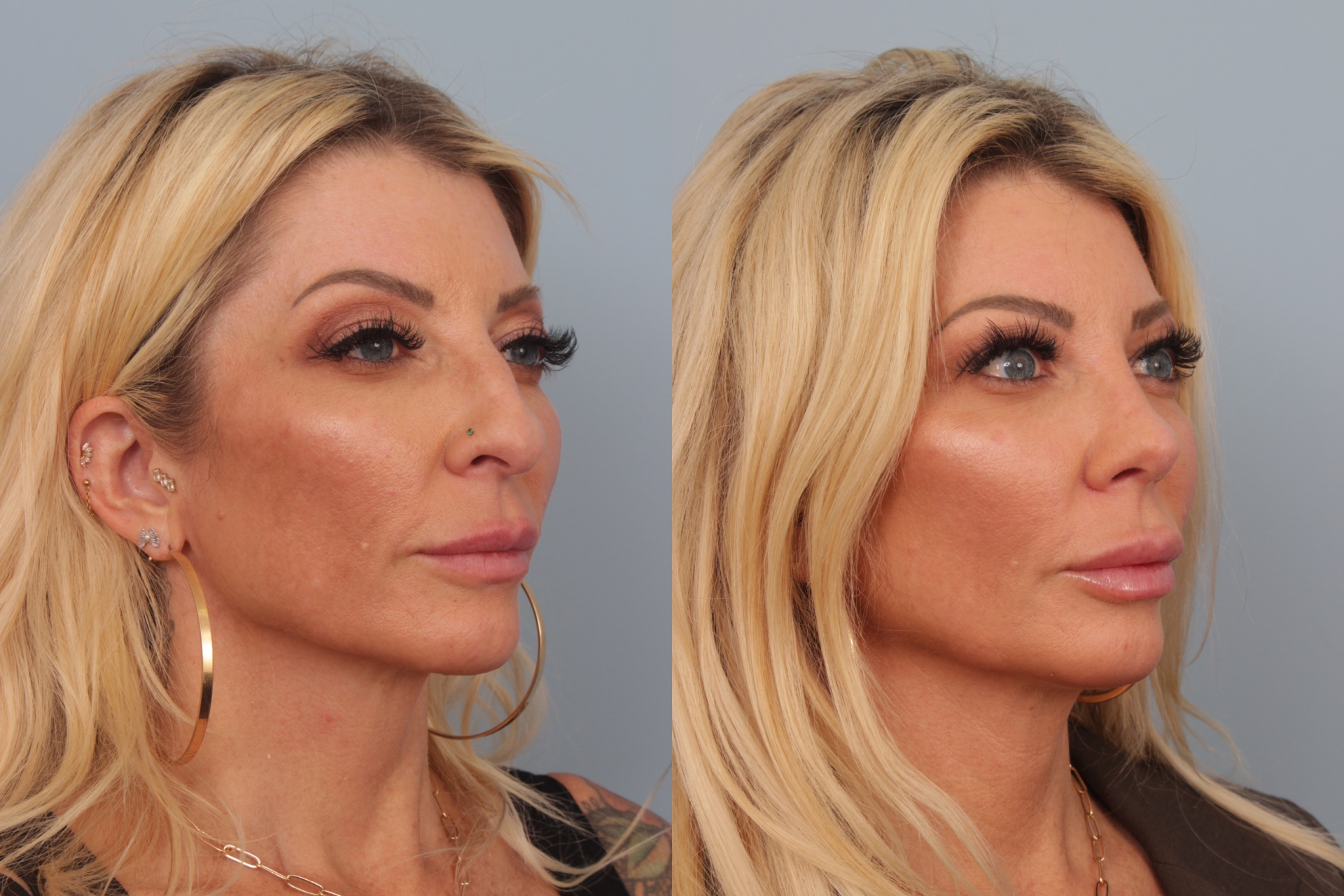 before_after_img
