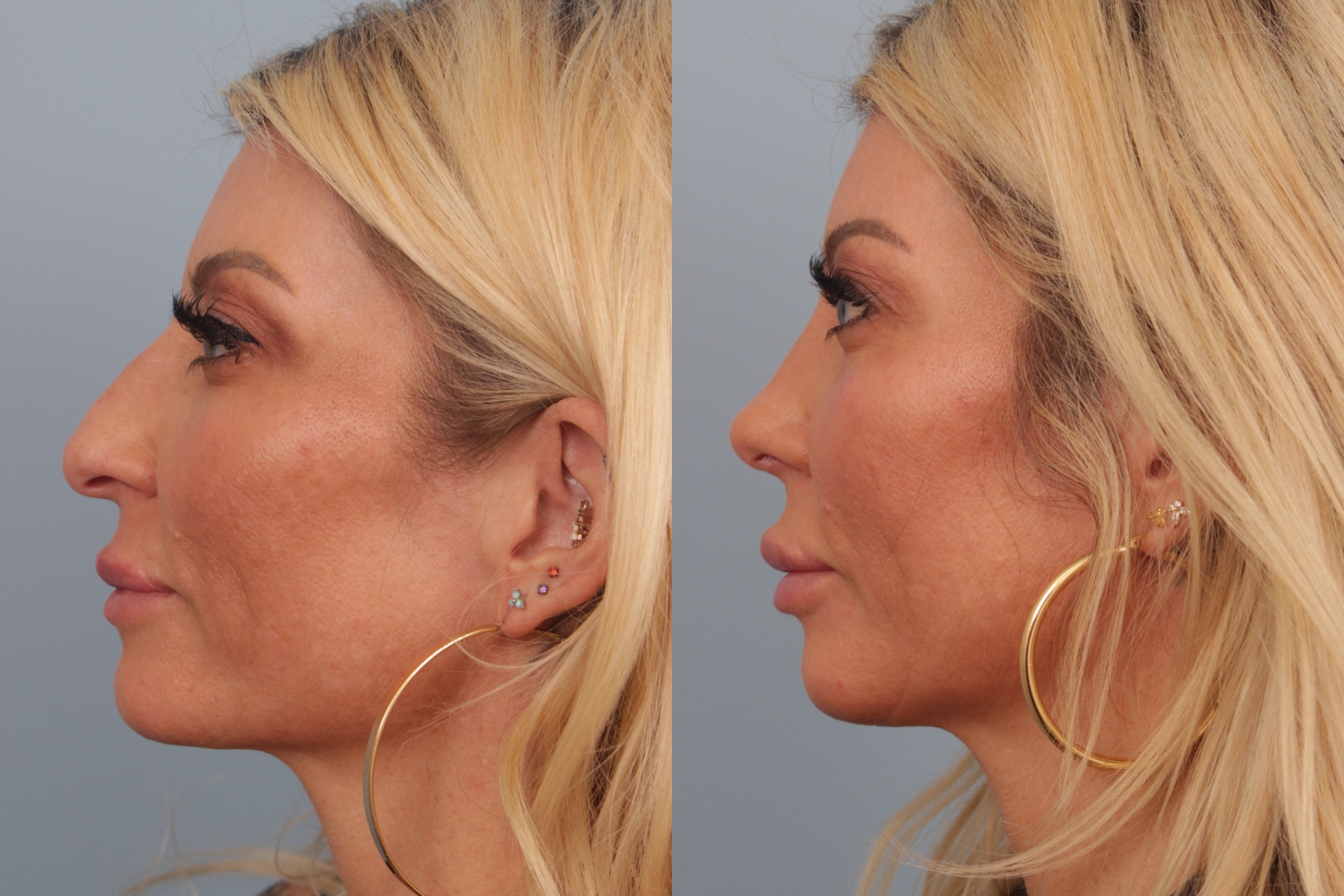 before_after_img