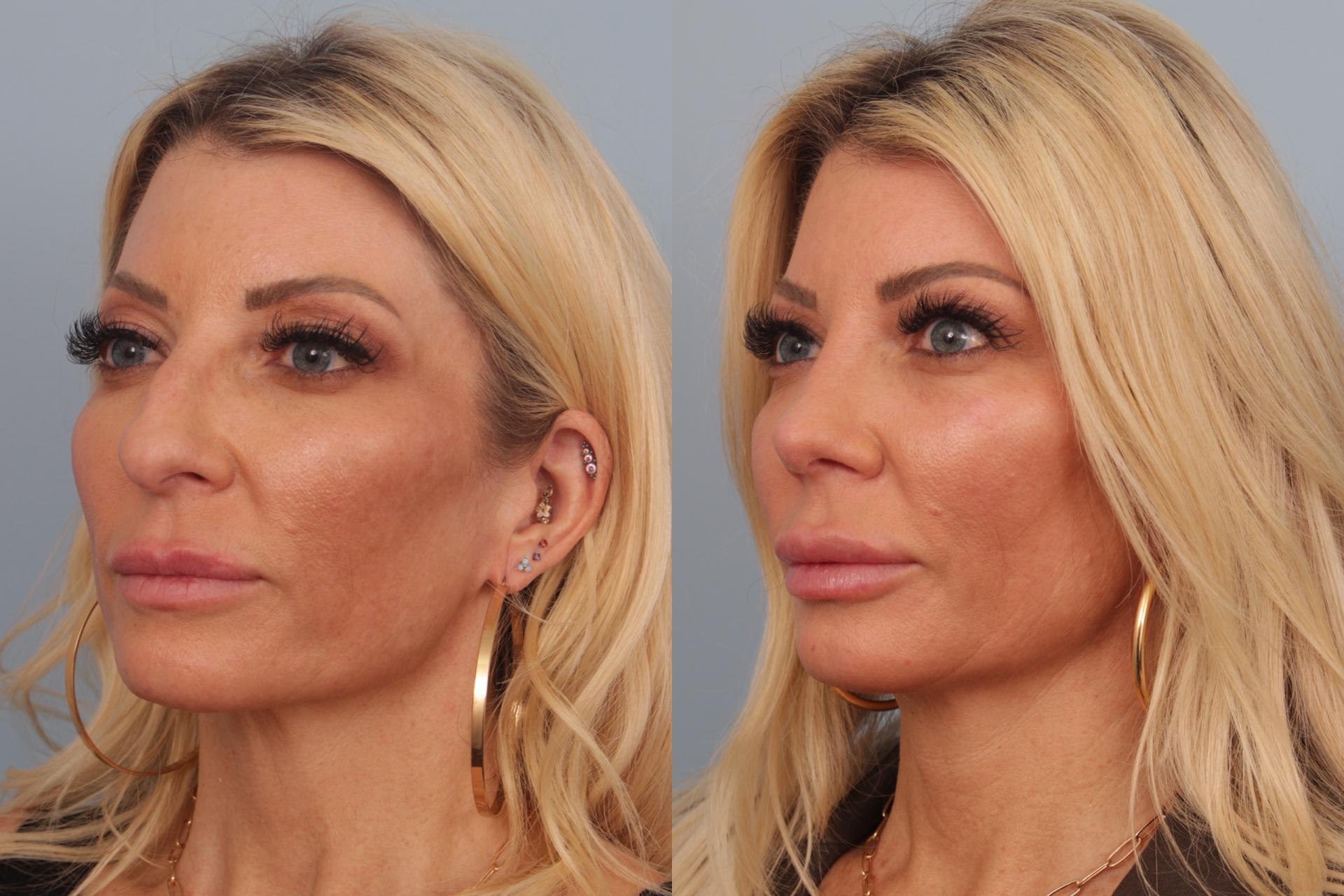 before_after_img