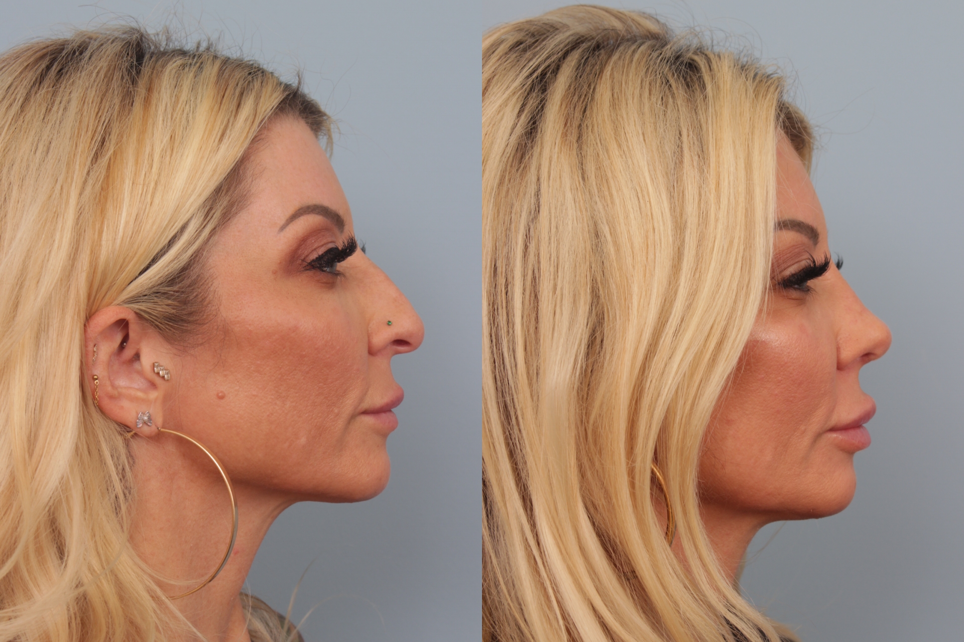before_after_img