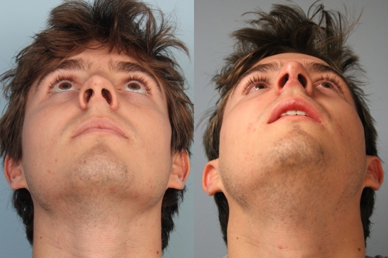 before_after_img