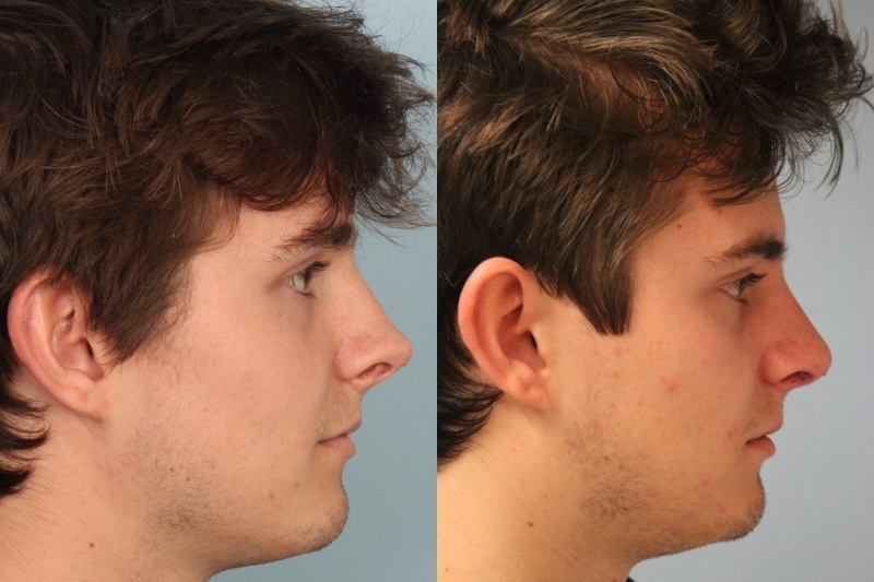 before_after_img