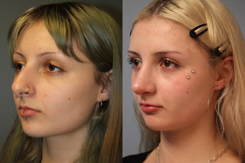 before_after_img