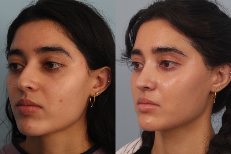 before_after_img