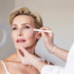Closeup,Of,Mature,Woman,With,Face,Contour,Lines,During,Anti-aging