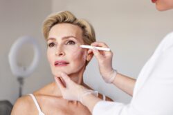 Rhinoplasty