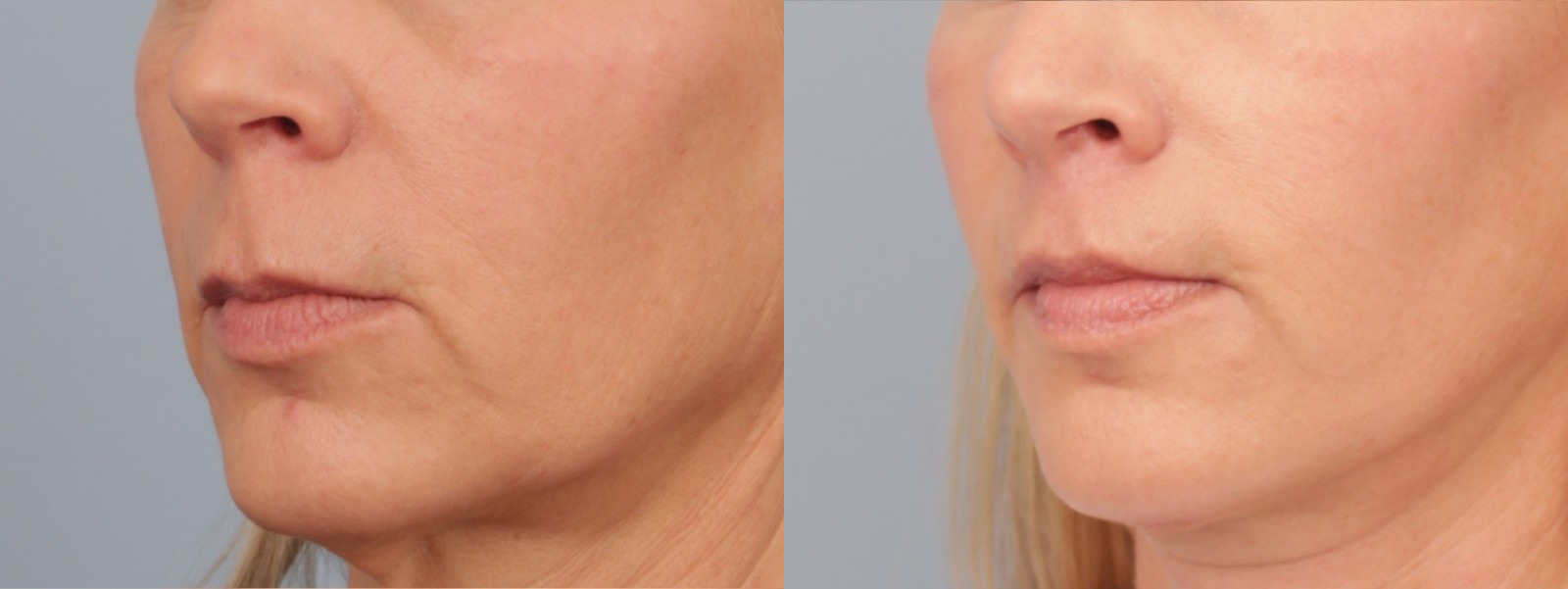 before_after_img